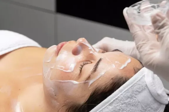 Mujer recibiendo tratamiento de Peeling Químico